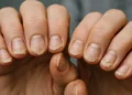 Unhas fracas: como tratar e mantê-las fortes e saudáveis com hábitos simples