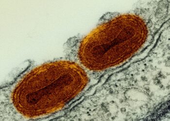 Imagem microscópica de novo vírus (mpox)