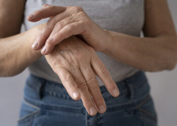 Osteoporose: descubra o hábito que mais afeta seus ossos e saiba como evitar!