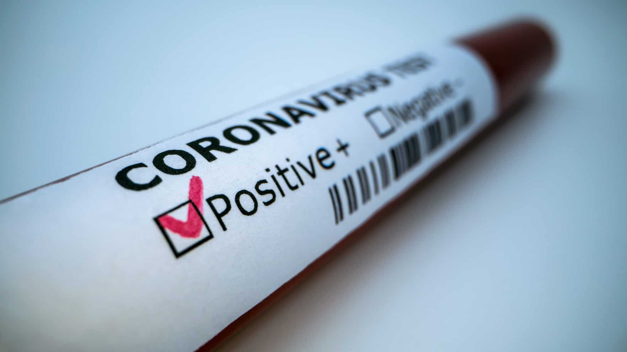 Coronavírus força 40 MIL trabalhadores a solicitarem auxílio doença em 2020