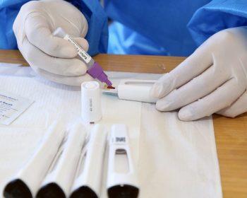 Com prejuízo de R$ 80 mi, vacinas e testes de COVID-19 vencem sem utilização