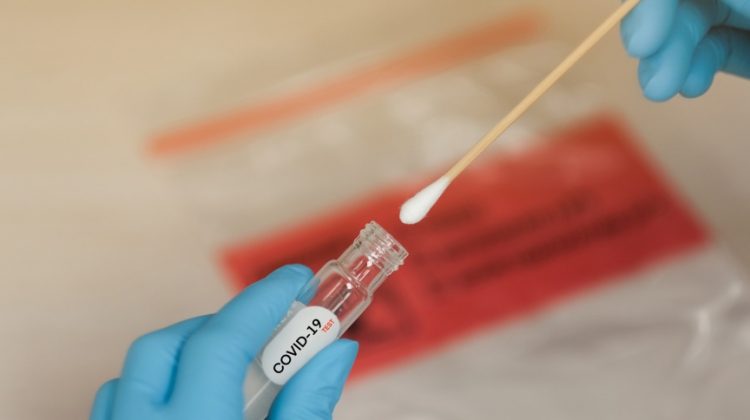 Com prejuízo de R$ 80 mi, vacinas e testes de COVID-19 vencem sem utilização