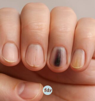 Unhas que falam: o que o formato e aspecto delas podem revelar sobre sua saúde