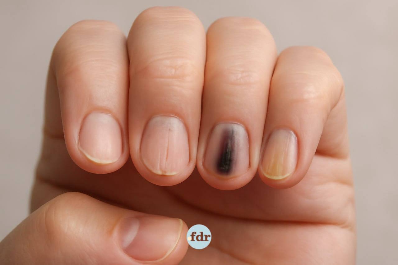 Unhas que falam: o que o formato e aspecto delas podem revelar sobre sua saúde