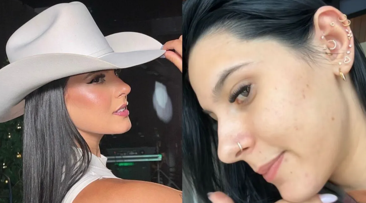 Roacutan foi a salvação para a pele dessa cantora famosa! Saiba quem pode usar