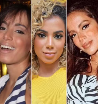 Anitta de rosto novo: Cantora já fez mais de 50 cirurgias, de R$ 2 mil a R$ 37 mil