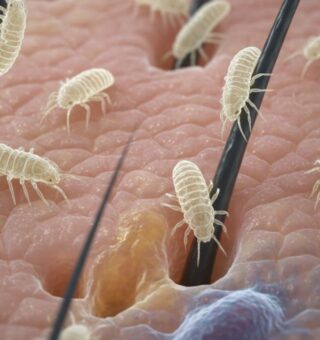 Imagem do Demodex na pele