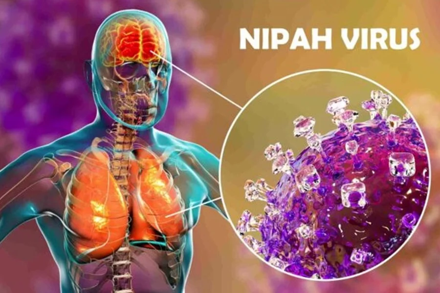 nipah vírus
